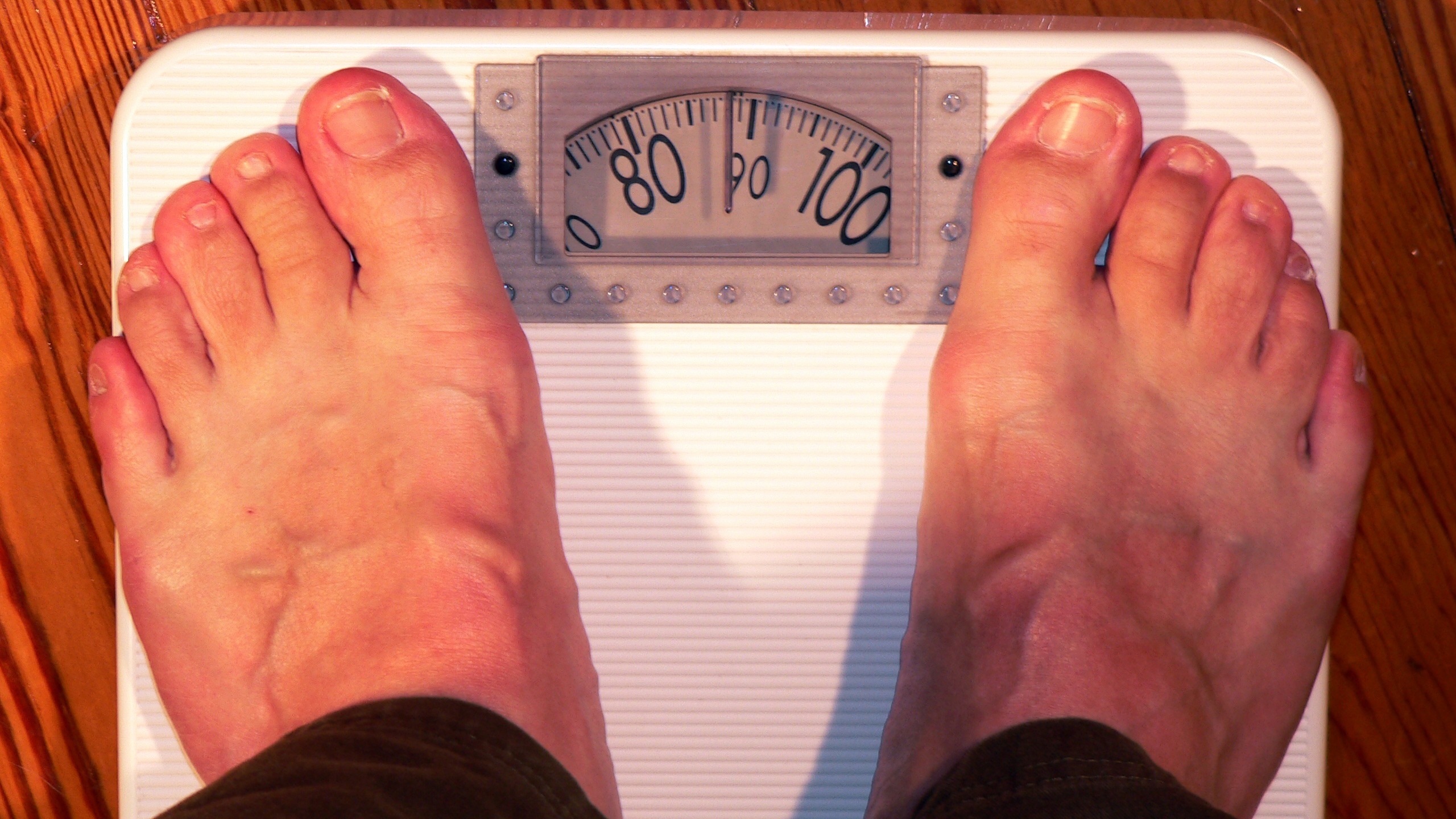 Диетолог опровергла популярные мифы об ожирении: широкие кости тут не при чем