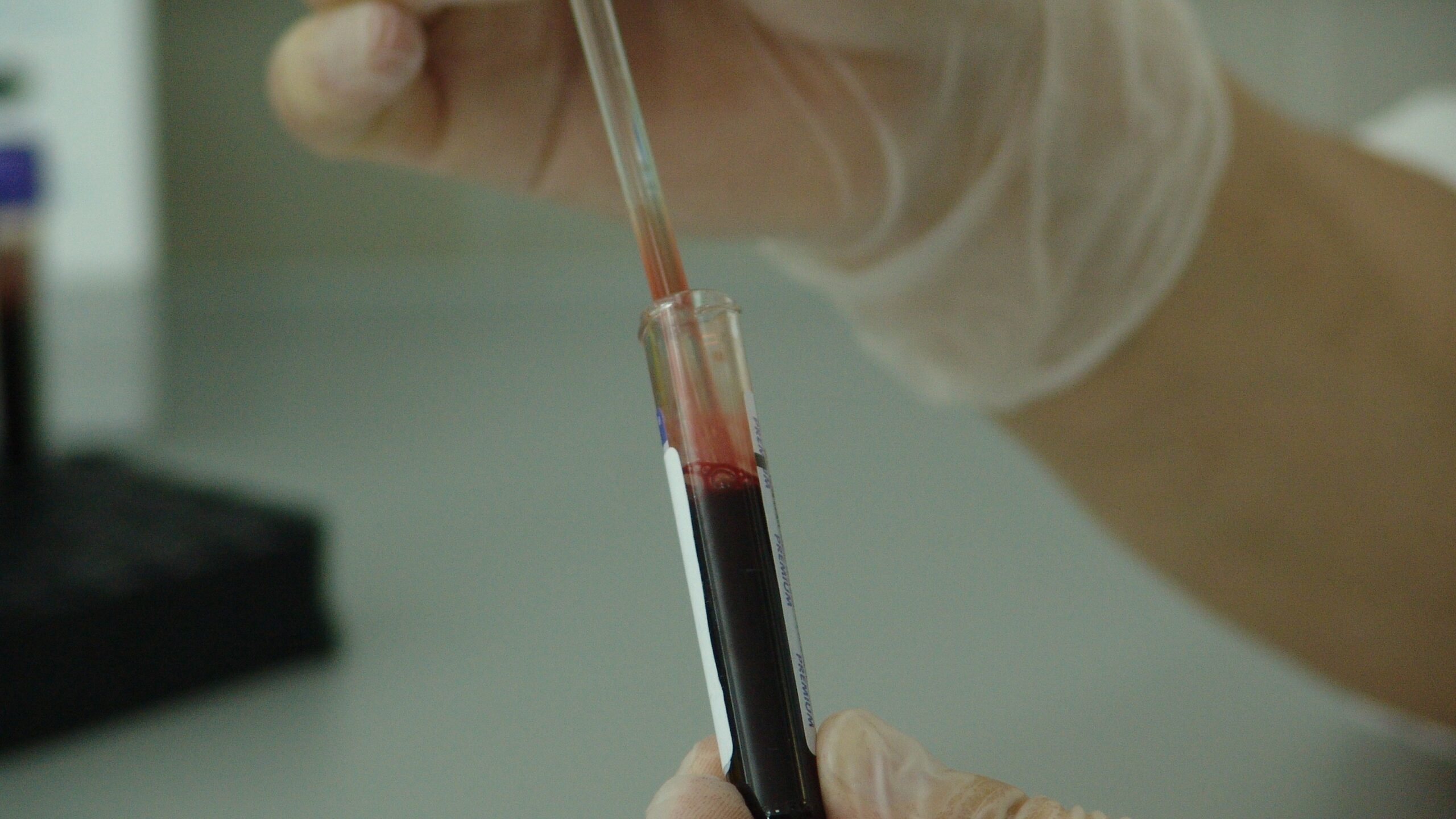 Ученые выяснили, как группа крови влияет на характер человека