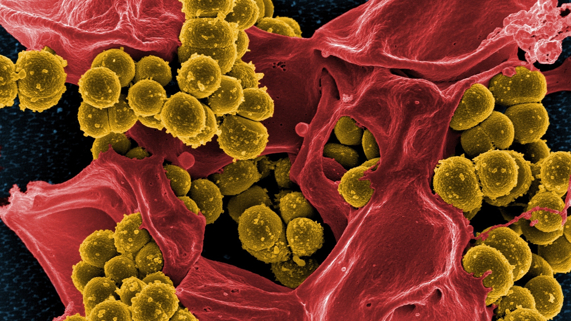 Смертоносная болезнь все ближе: Грибок Aspergillus сотрет Европу с лица земли?